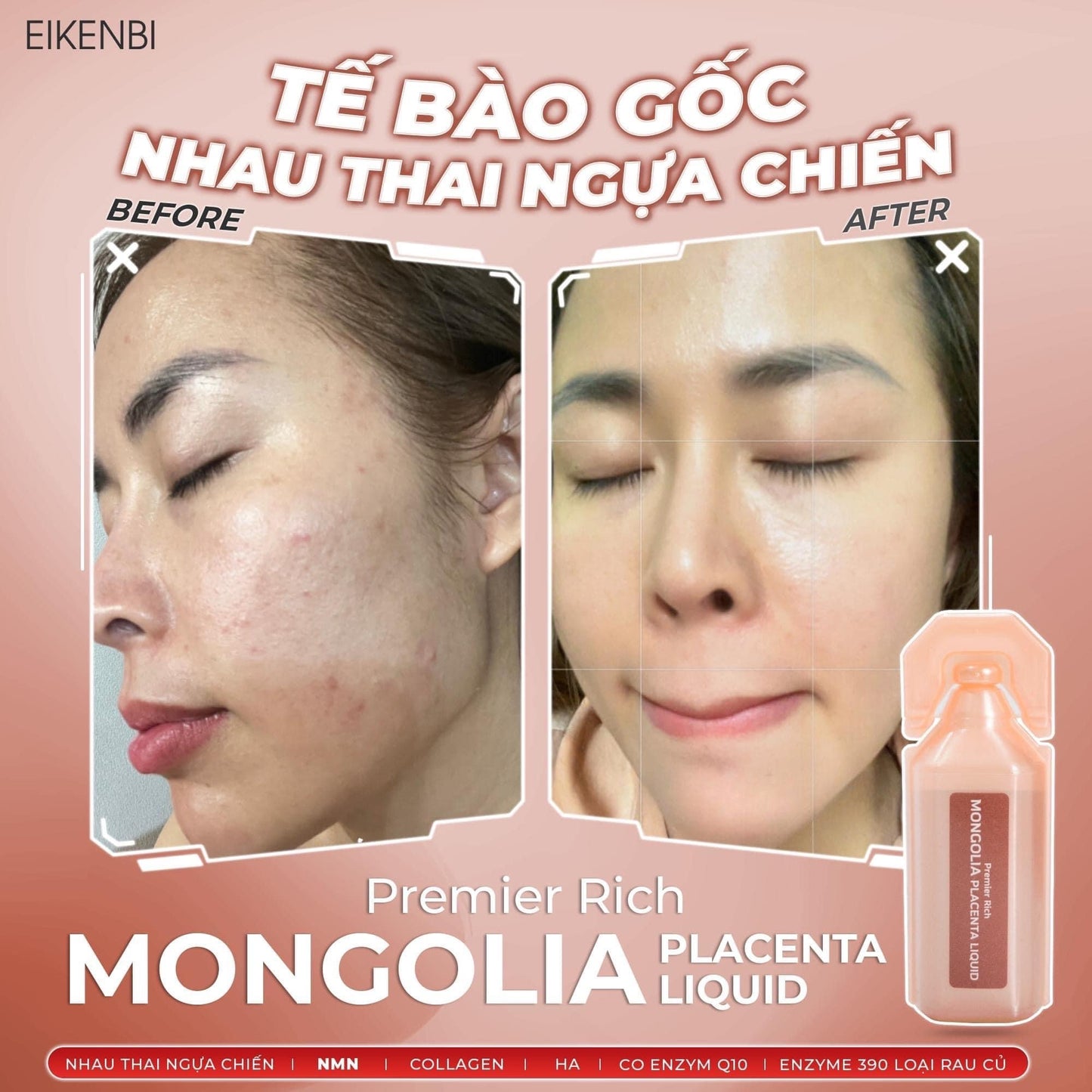 Mongolia nhau thai ngua chien