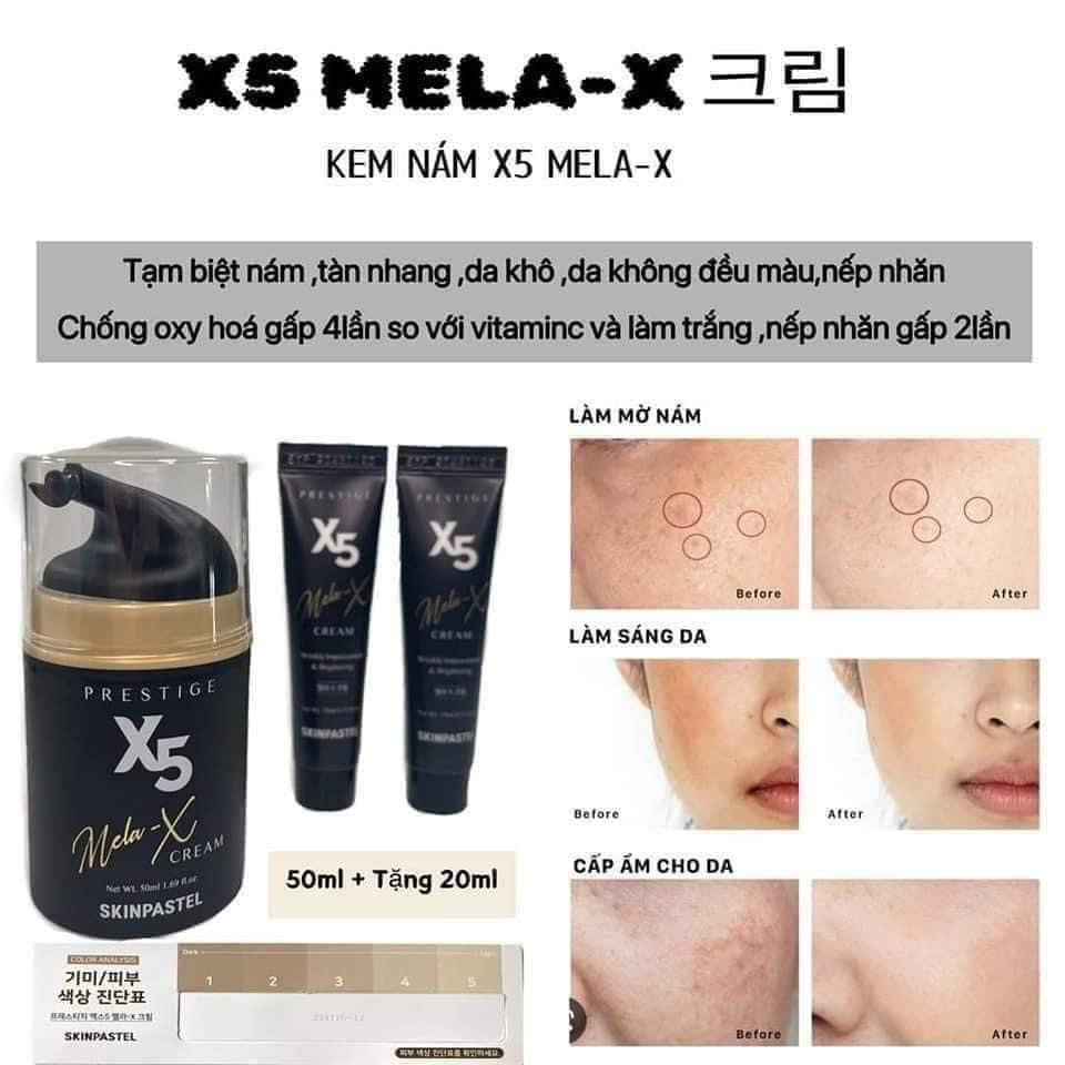 Set tri nam mela x5