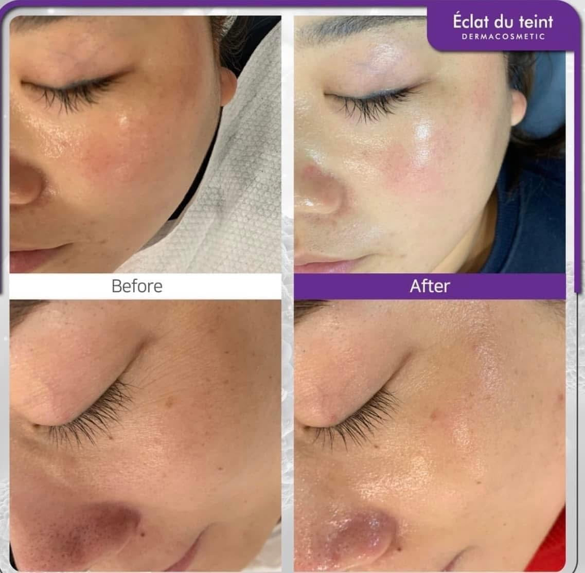 ECLAT DU TEINT Dewy Intensive Cream Kem Booster Kích Trắng An Toàn