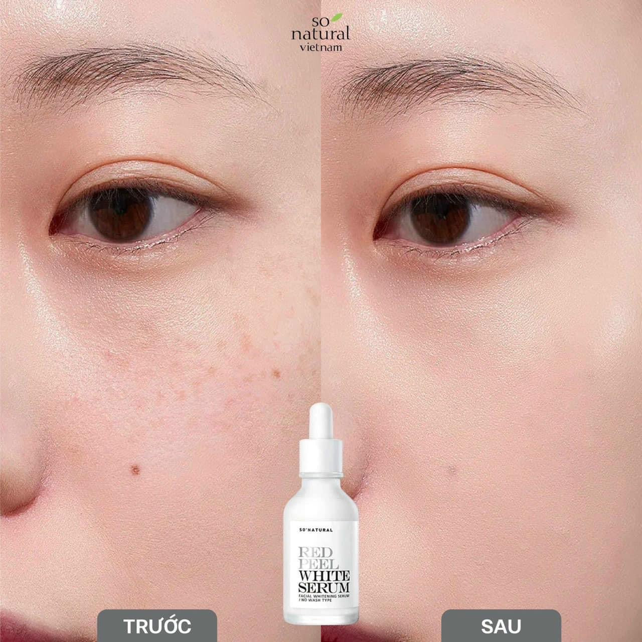 Red peel white serum