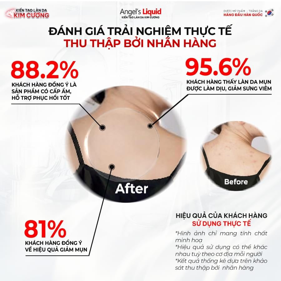 Xịt mụn lưng glutathione mẫu mới