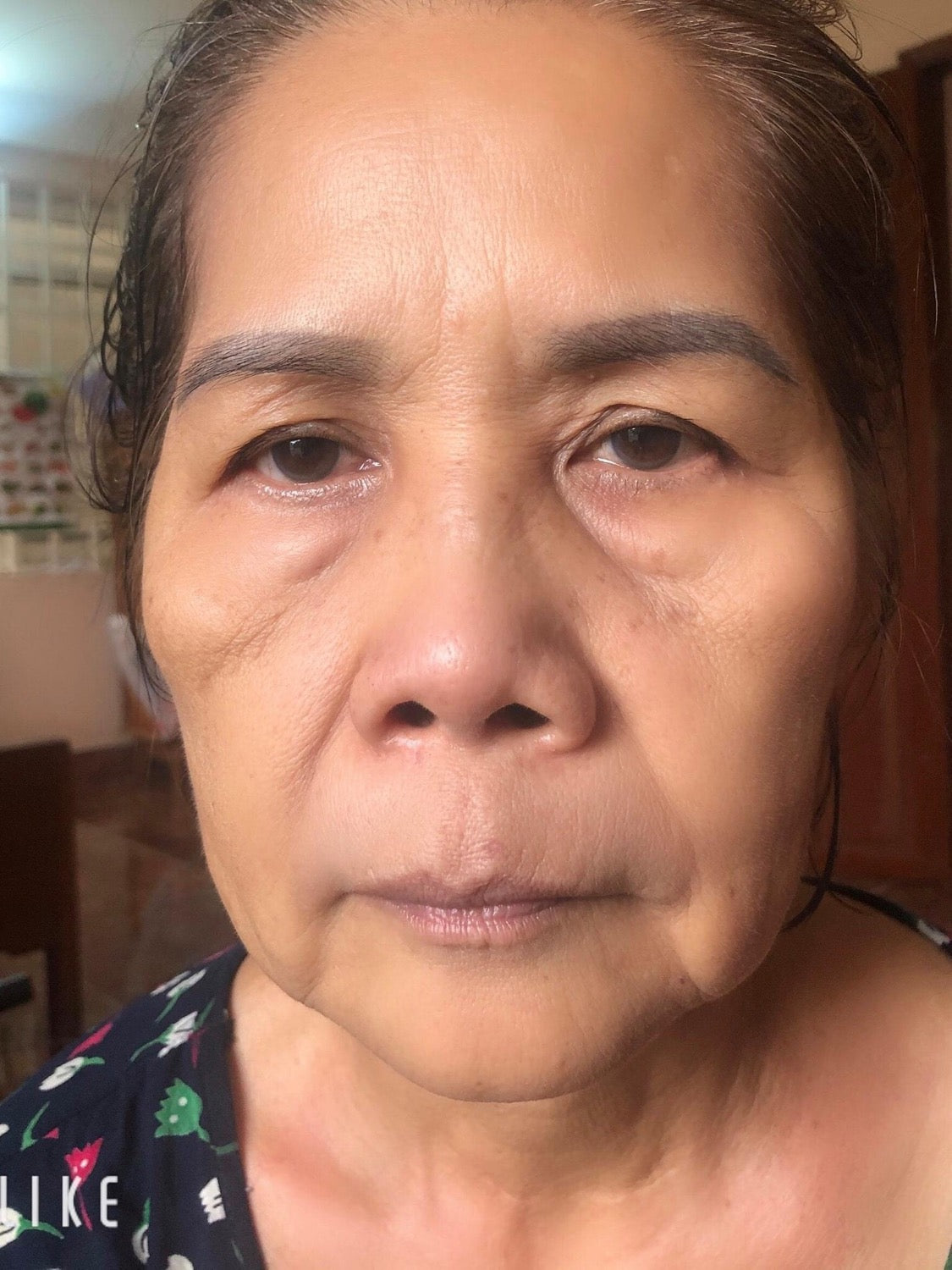 Facial Line up lifting gel (4gói)