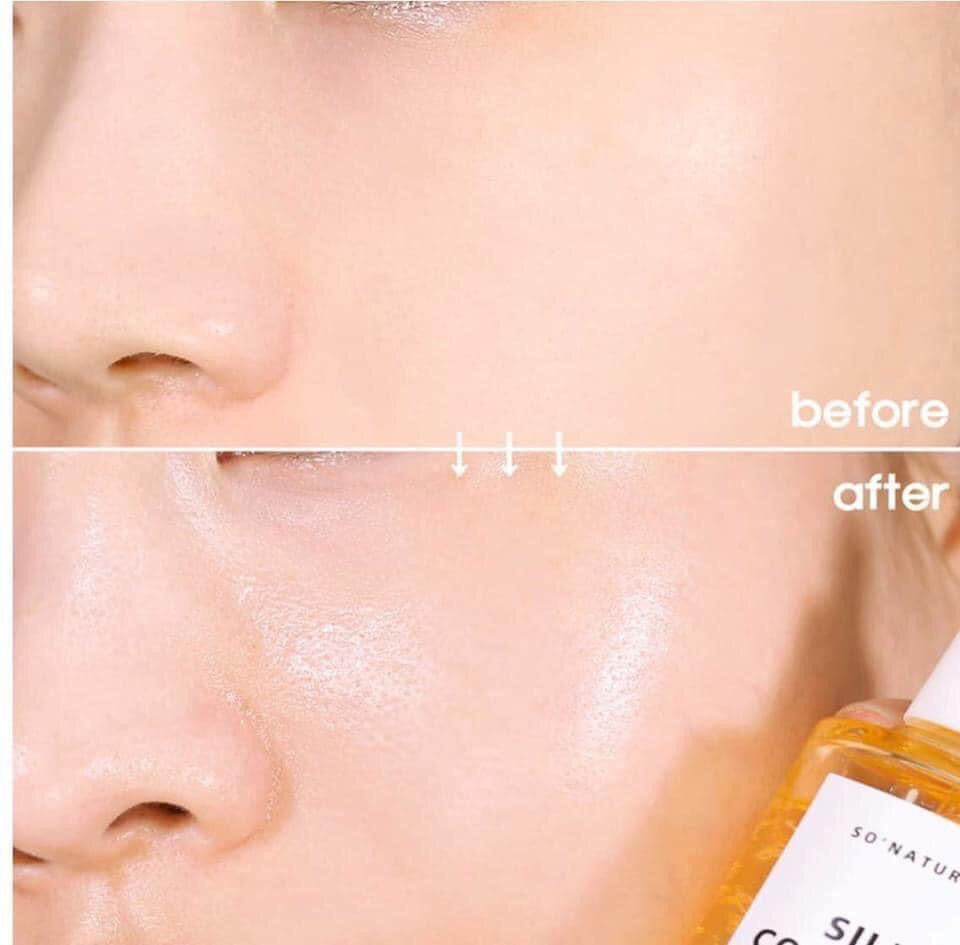SO NATURSILK COLLAGEN GLOW AMPOULE - Anti-Aging Serum, Intense Hydration + Mo