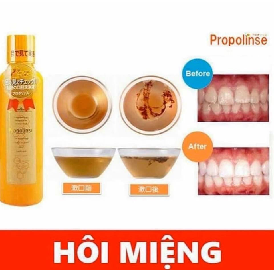 Nuoc suc mieng Propolinse