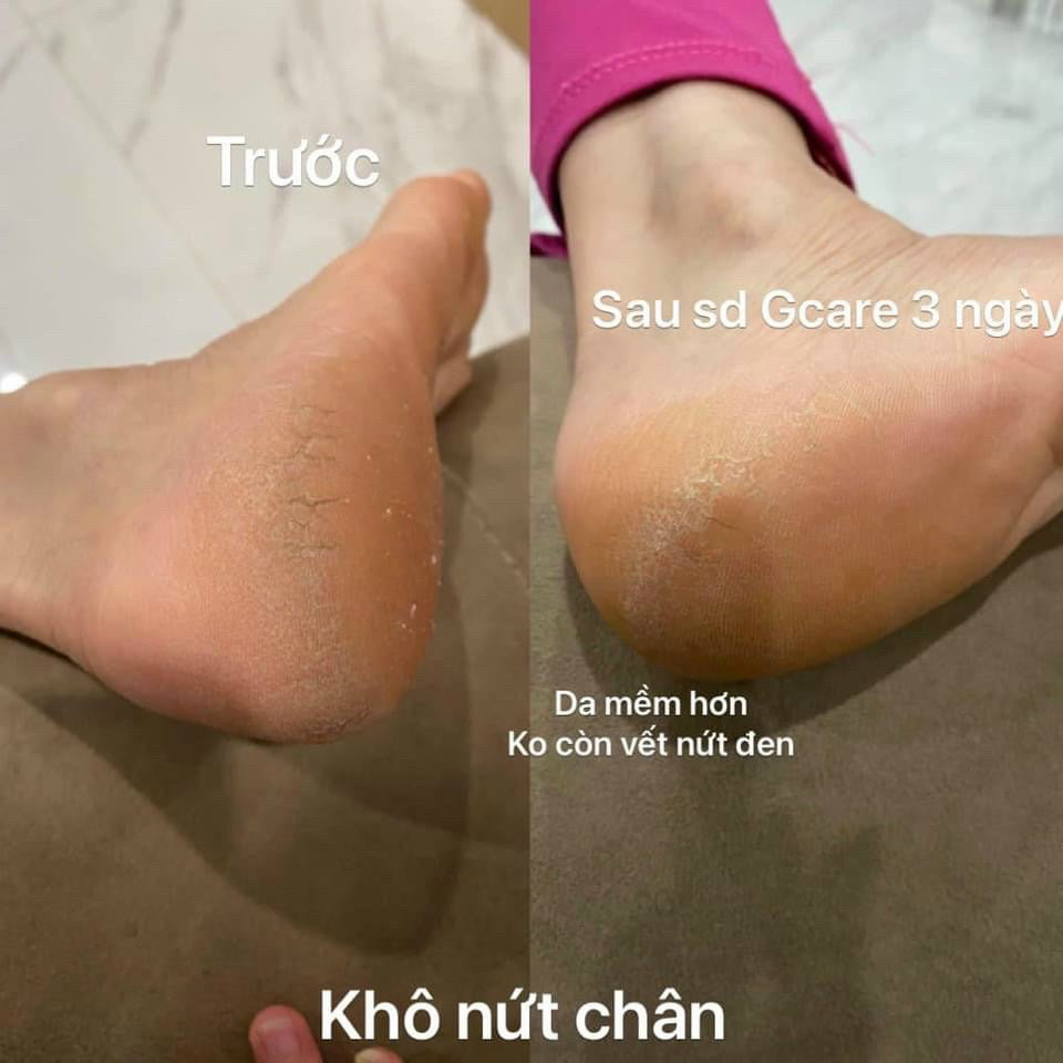 Gcare Kem viem da
