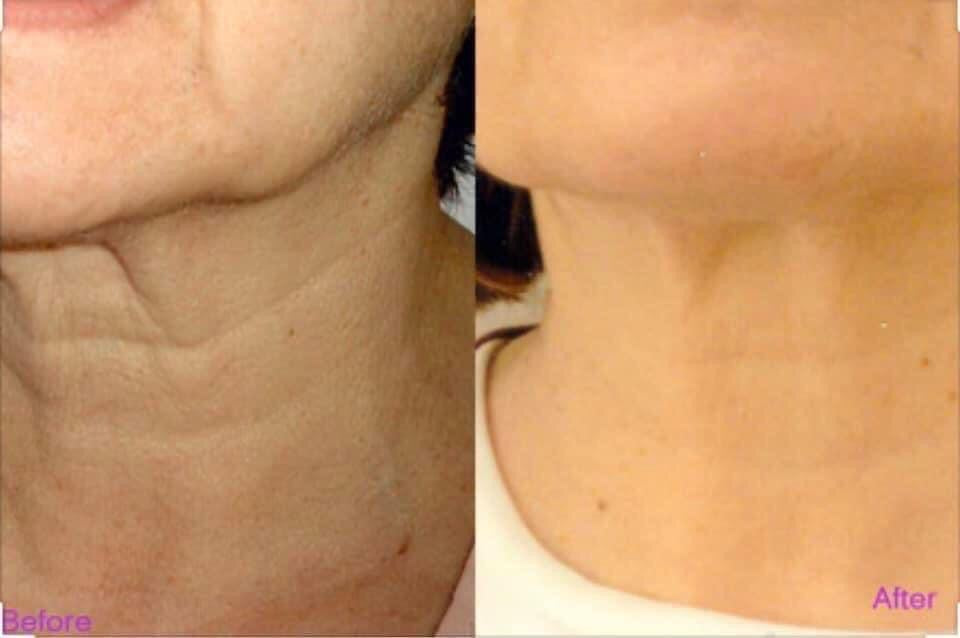 Kem duong co Naite Thread neck cream