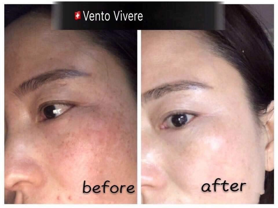 PEARL RARE Vento ILLUMINATING CELLULAR CREAM