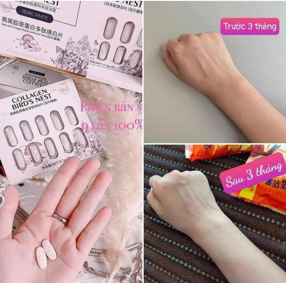 Vien uong collagen to yen ( china)