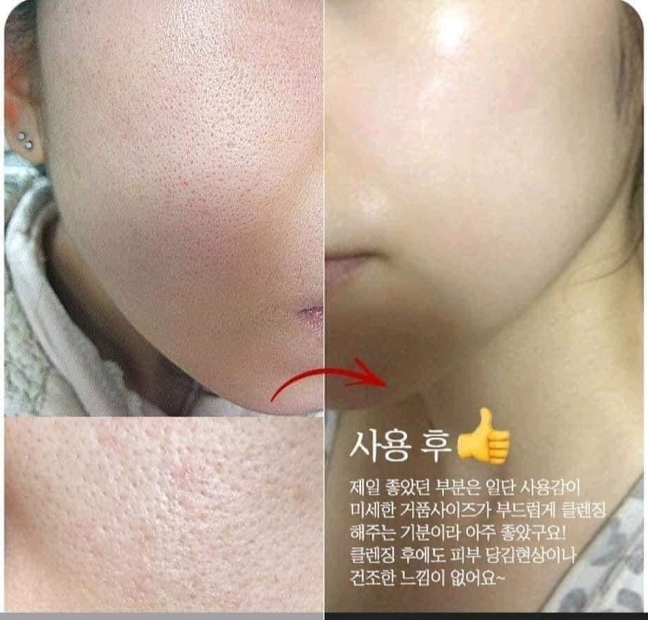 Serum nhan sam vàng 24k Frigga