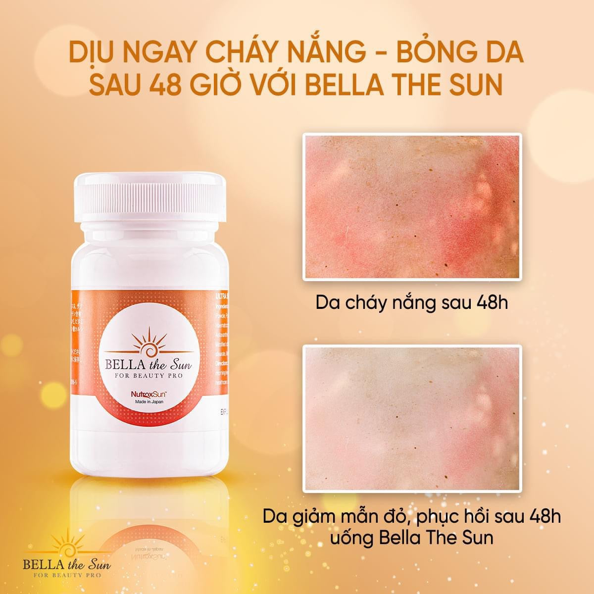 Vien uong chong nang Bella The Sun