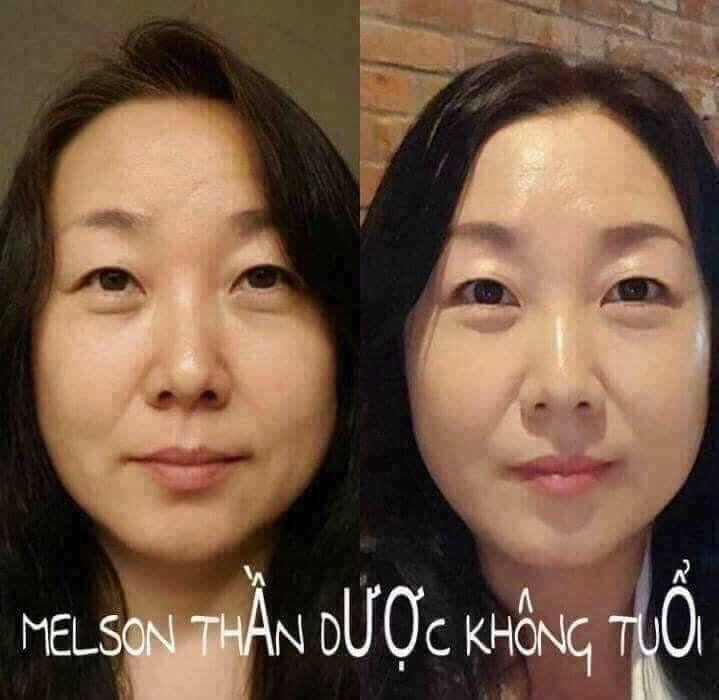 Melsmon Platinium Liquid