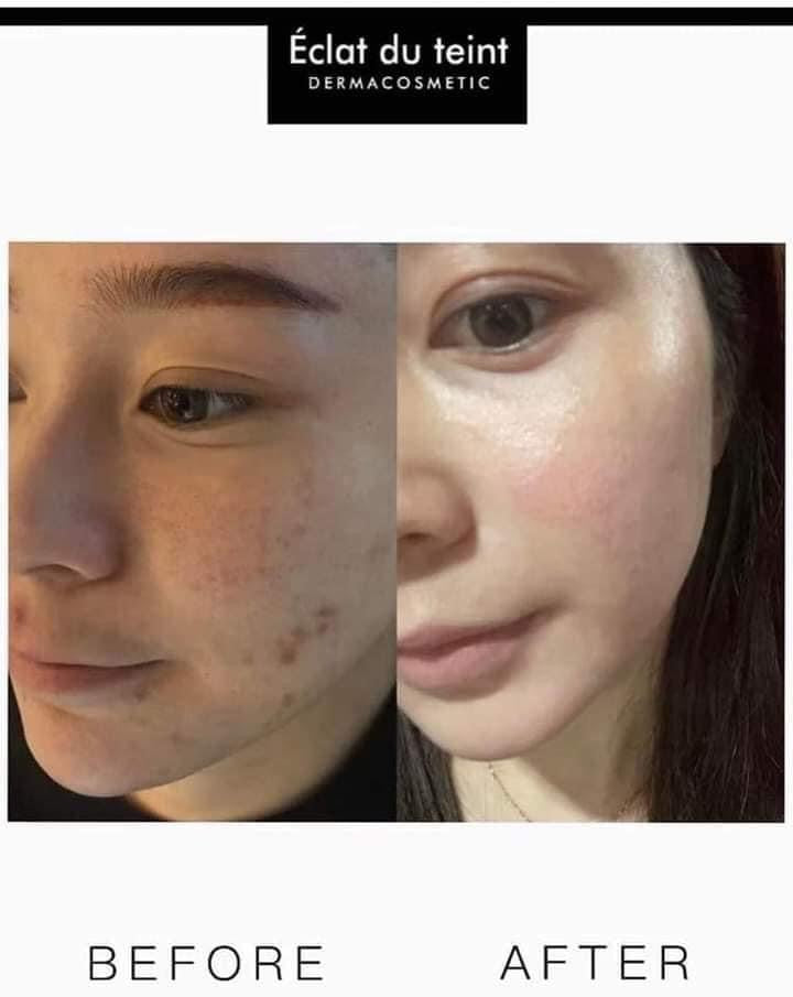 Blanc sponge mask mat na u trang