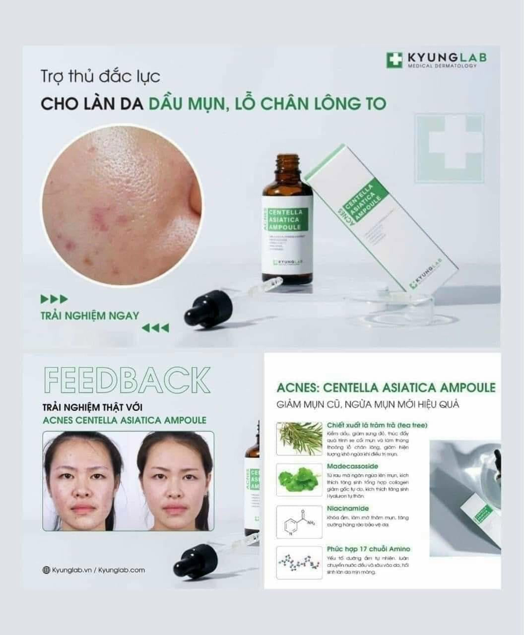 Serum mụn Kyunglab