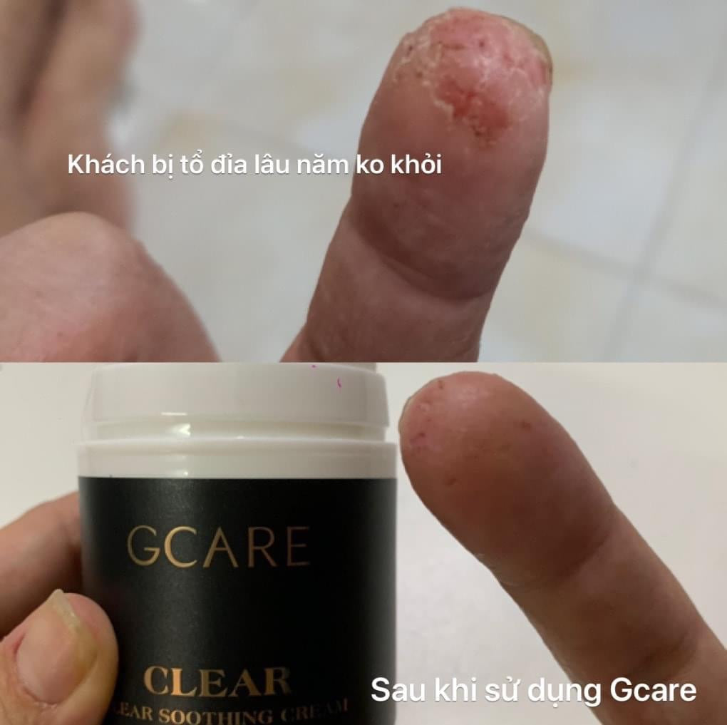 Gcare Kem viem da
