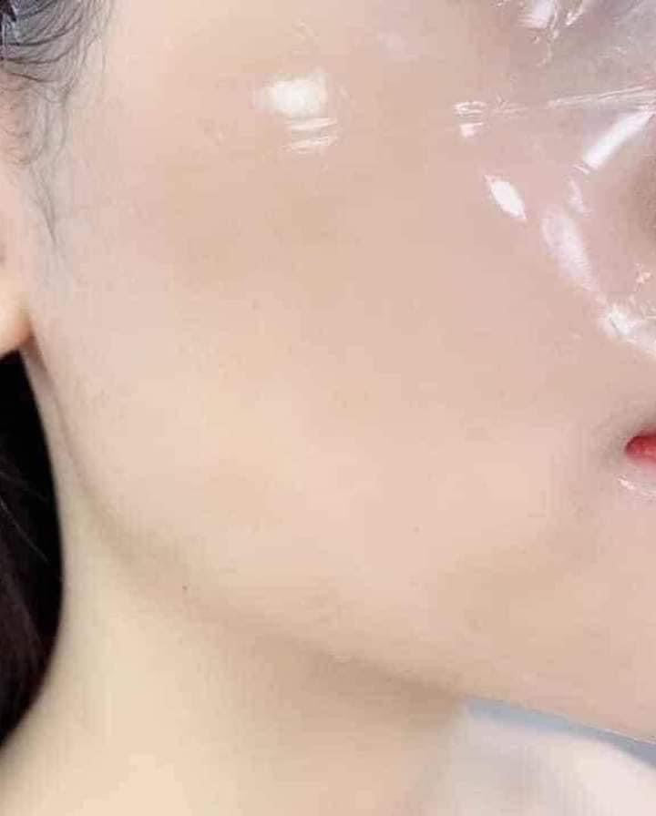 Mat na sinh học thach hong celderma (4m)