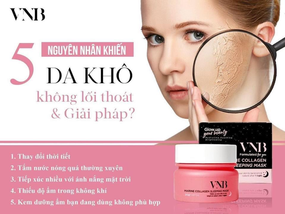 Mat na ngu VNB ( vietnam )