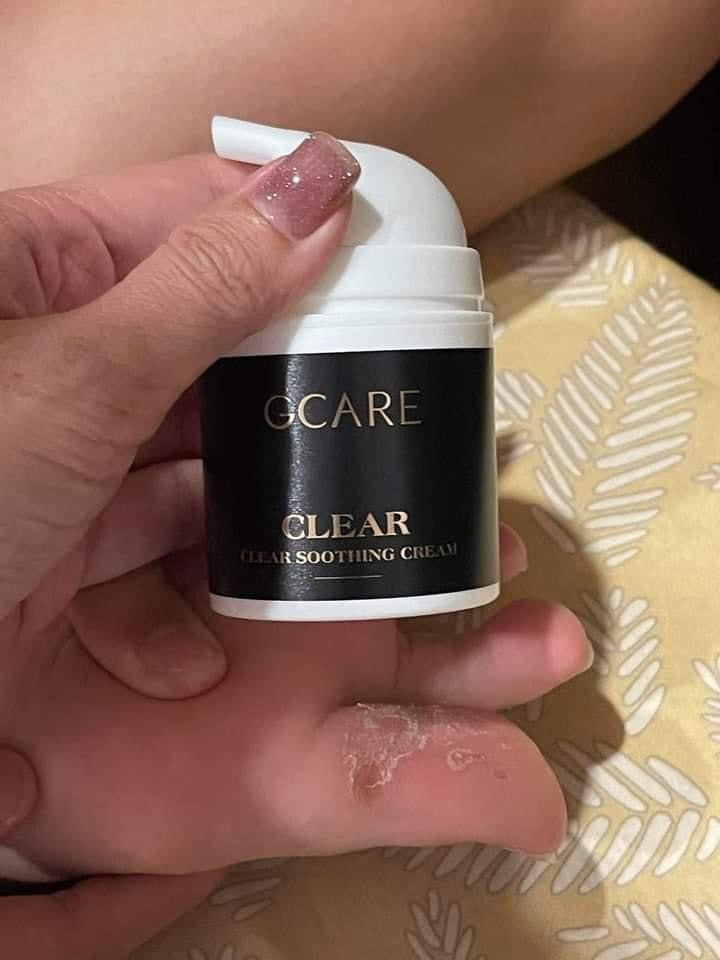 Gcare Kem viem da