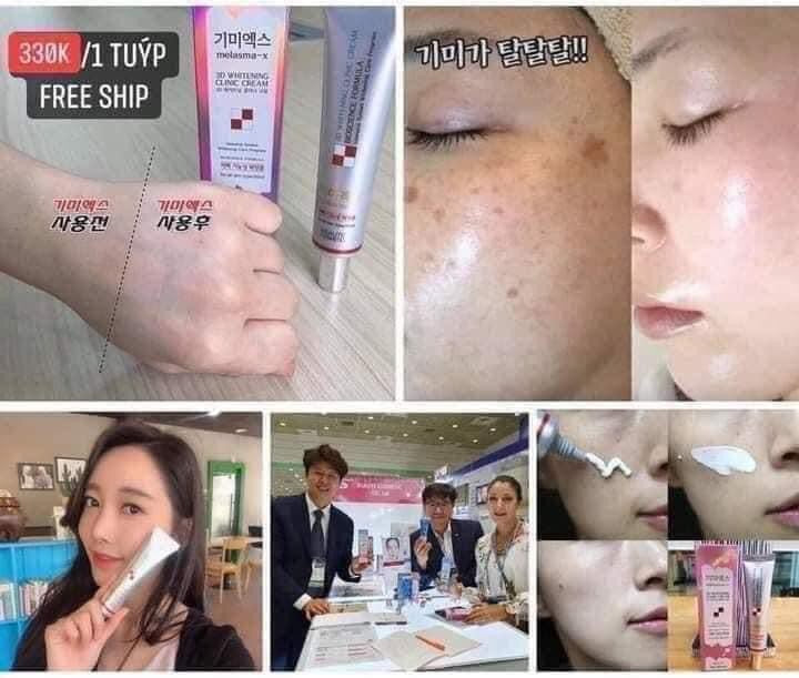 Kem nam 3D clinic cream