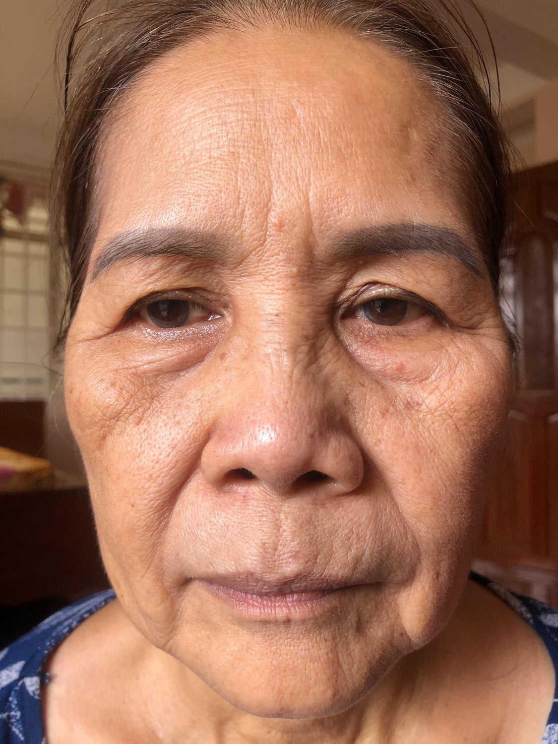 Facial Line up lifting gel (4gói)