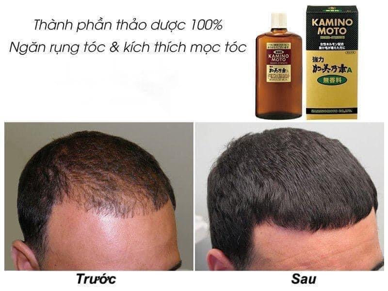 Huyet thanh moc toc Kamino Moto Japan
