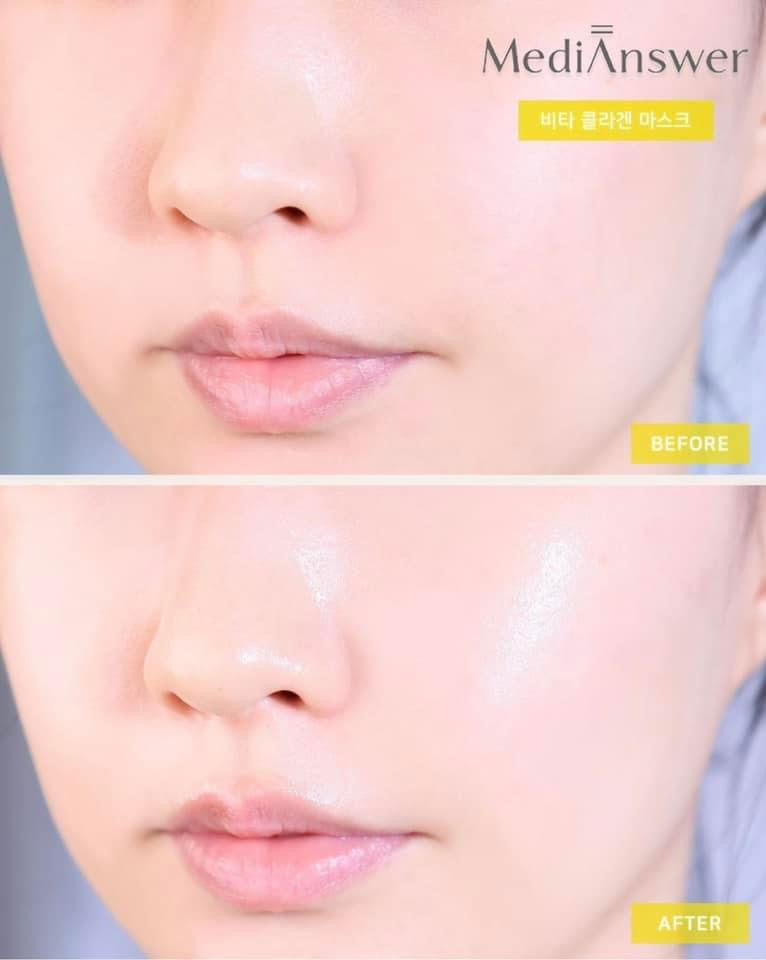 Mat na medianswer Vita collagen