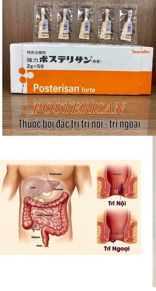 Posterisan thuoc boi tri (50 typ)