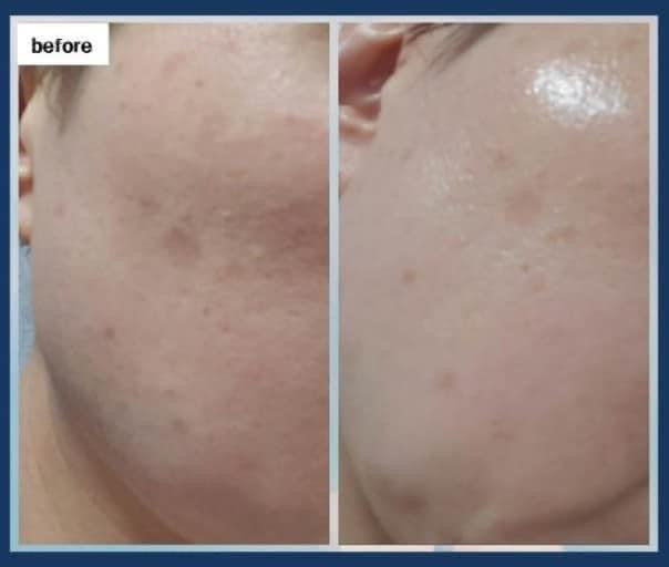 Serum Vita C13