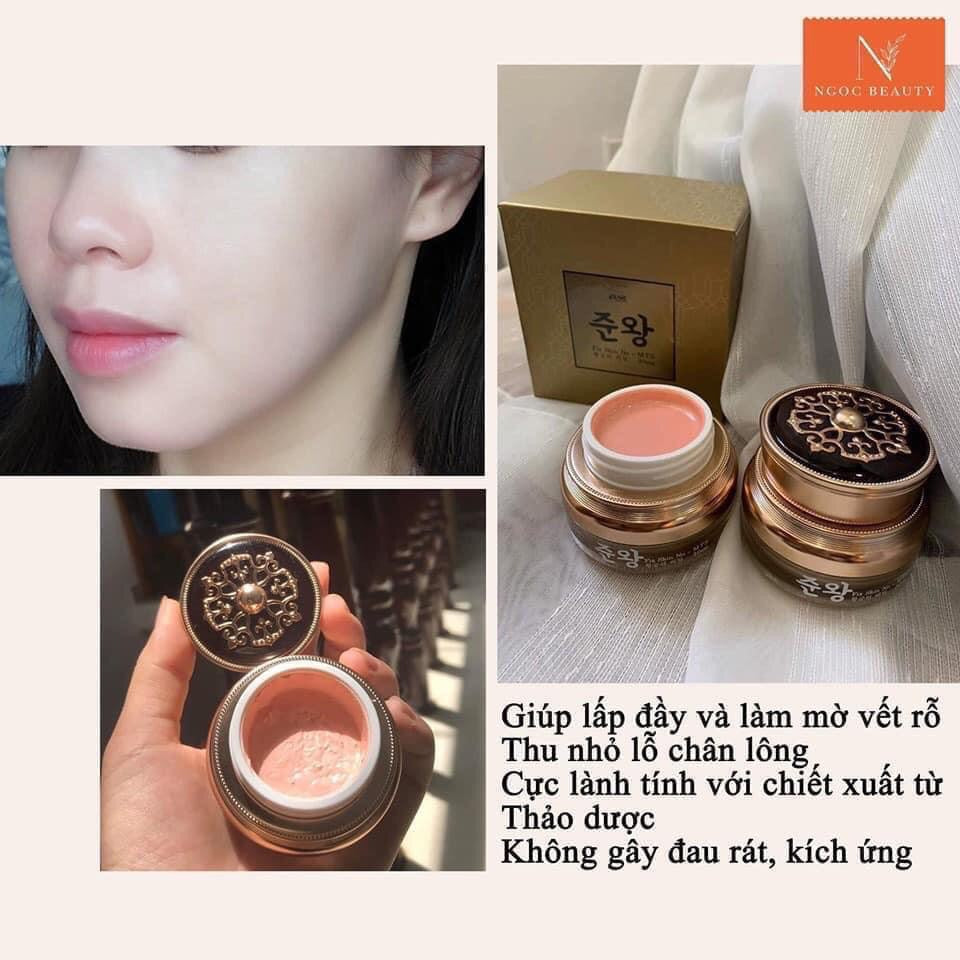 Kem tri rổ Genie SCAR- ACNE SCAR TREATMENT Korean Cream MADE IN KOREA