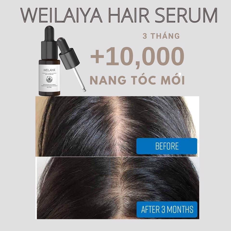 Huyet thanh moc toc weilaiya
