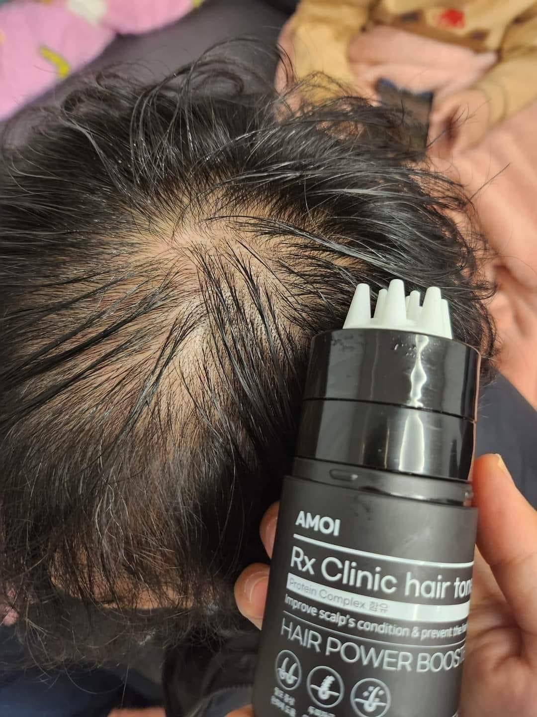 Amoi hair toner lan moc toc