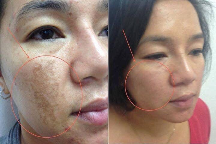 PEARL RARE Vento ILLUMINATING CELLULAR CREAM