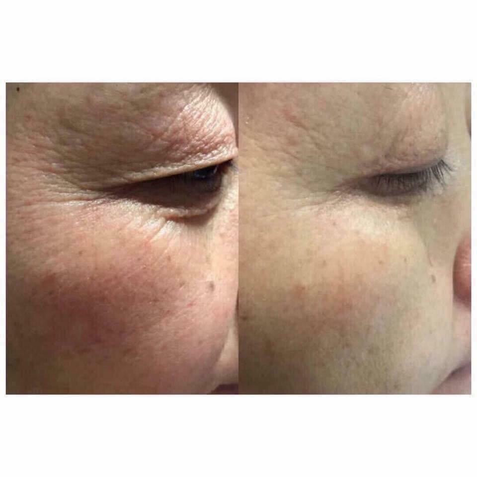 LUXE CAVIAR CELLULAR SERUM vento