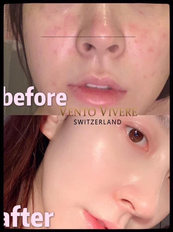 PEARL RARE Vento ILLUMINATING CELLULAR CREAM