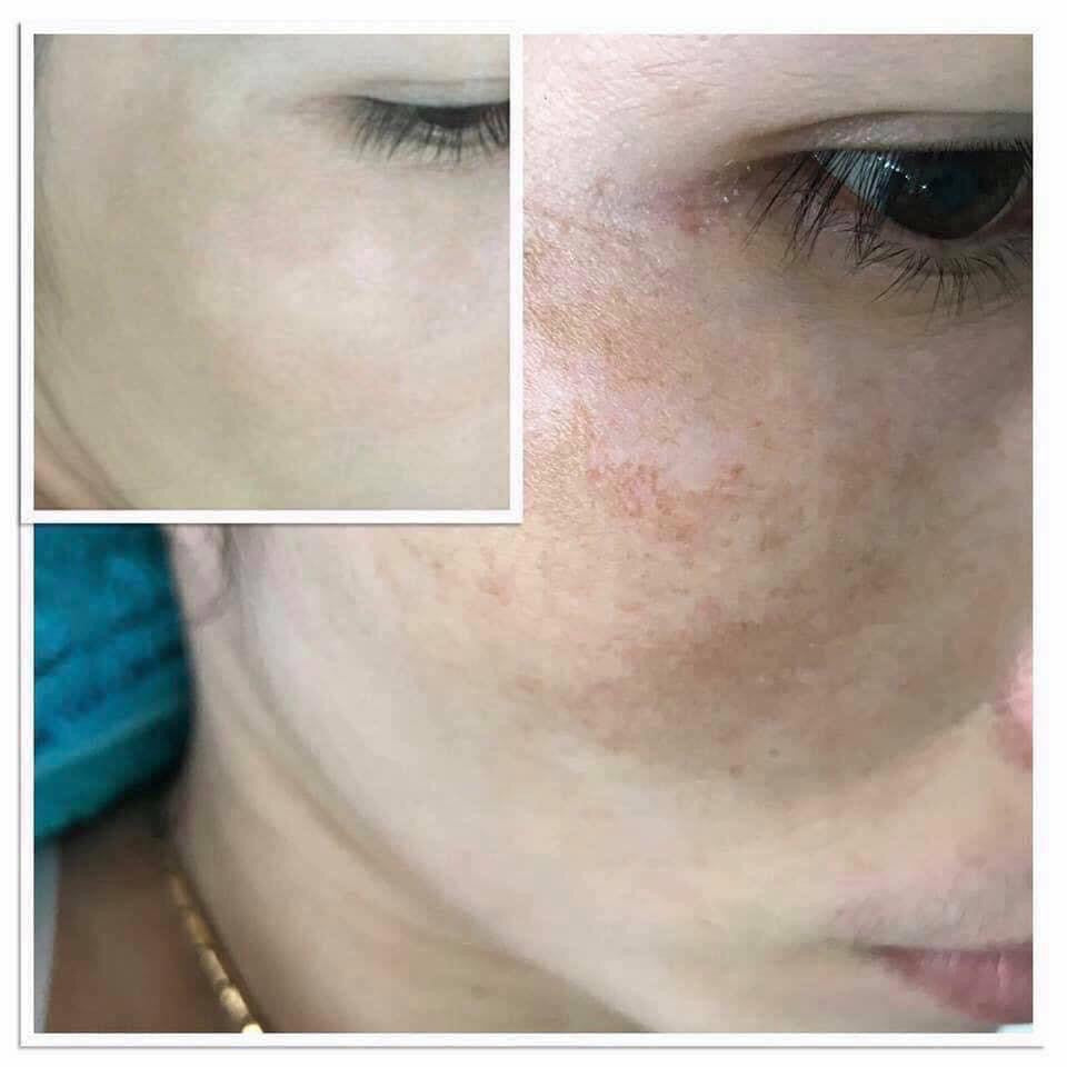PEARL RARE Vento ILLUMINATING CELLULAR CREAM