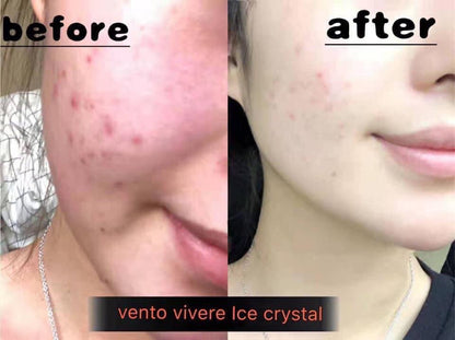 VENTO VIVERE ICE CRYSTAL SERUM