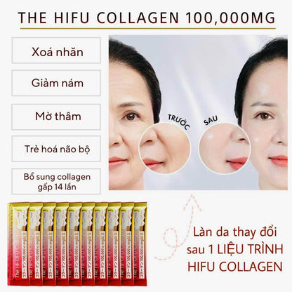 Collagen Hifu (10 gói)