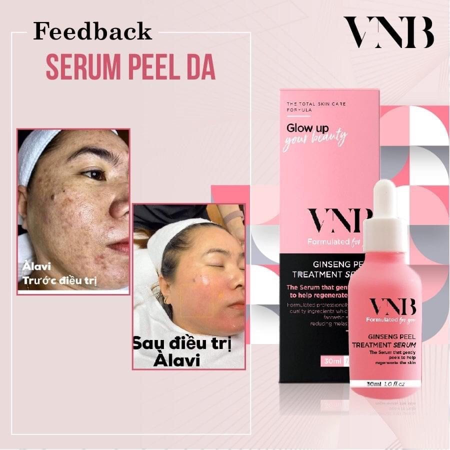 Serum Peel da VNB Vietnam