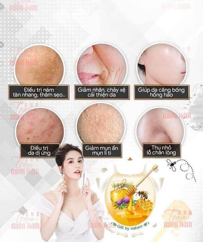 Set keo ong Ampoule Pure tang 1 may ion