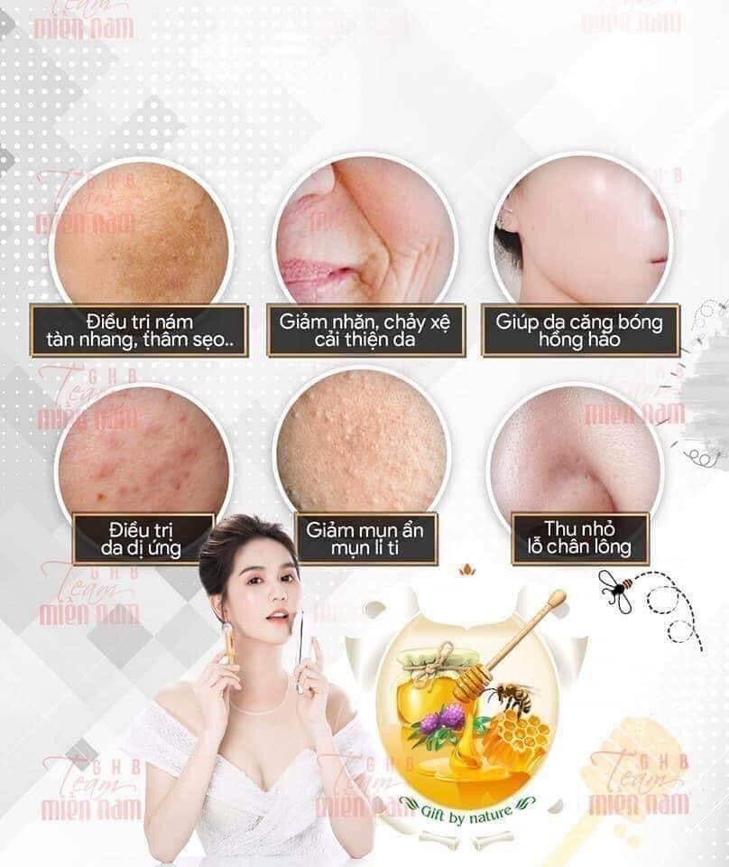Set keo ong Ampoule Pure tang 1 may ion