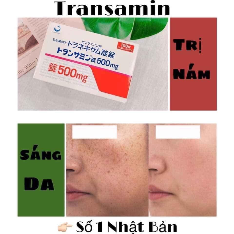 THUỐC TRẮNG DA TRỊ NÁM TRANSAMIN